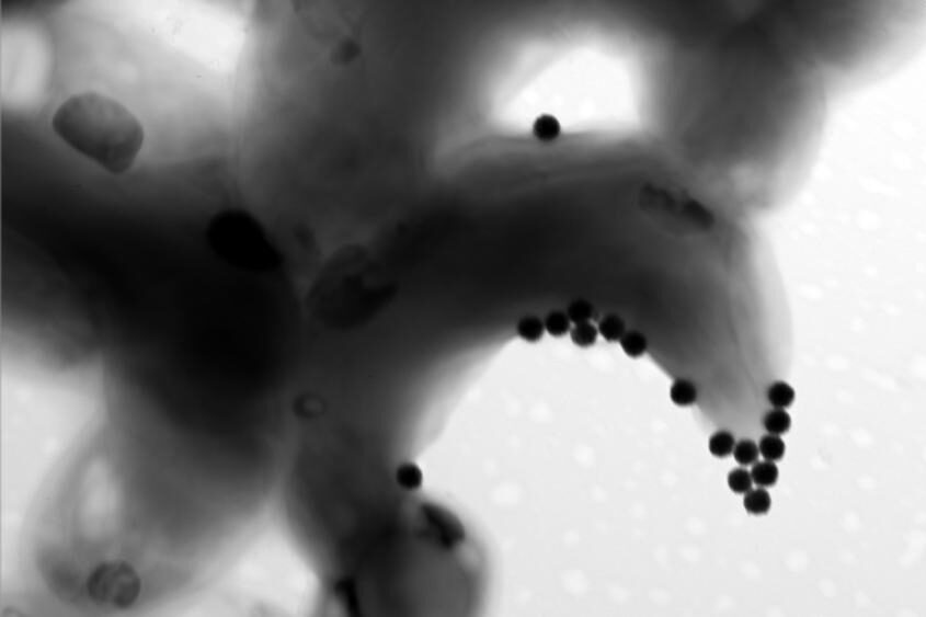 Eine Mikroskopaufnahme zeigt kleine schwarze Nanoplastikpartikel, die an einer Algenzelle haften.